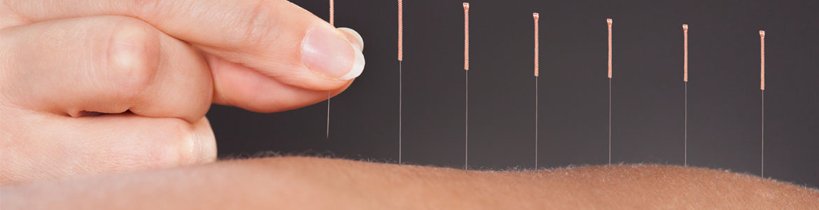 Acupuncture in Wisconsin Rapids, WI